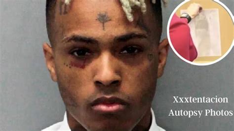 xxxtentacion autopsy photos leaked|XXXTENTACION Unseen Photos Surface